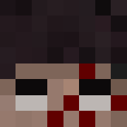 Blece