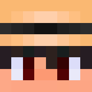 Tedzki