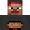 Peytz's skin