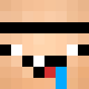 xHyperTMT
